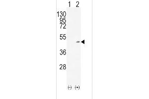 Western blot analysis of ADH1C (arrow) using rabbit polyclonal ADH1C Antibody (Center) (ABIN651725 and ABIN2840376). (ADH1C Antikörper  (AA 231-260))