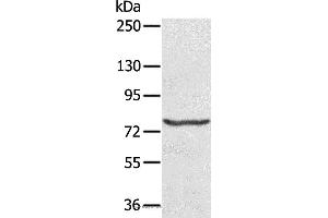 Western blot analysis of Hela cell, using MX1 Polyclonal Antibody at dilution of 1:200 (MX1 Antikörper)