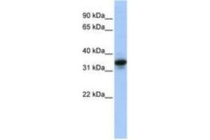 Image no. 1 for anti-Mucin 3B, Cell Surface Associated (MUC3B) (AA 36-85) antibody (ABIN6744267) (MUC3B Antikörper  (AA 36-85))