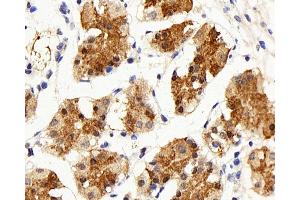 Immunohistochemistry analysis of paraffin-embedded human stomach using IL22RA1 Polyclonal Antibody at dilution of 1:200. (IL22 Receptor alpha 1 Antikörper)