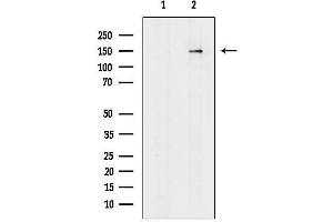 Western blot analysis of lysates from Hela cells(lps treatment), using HER3/Erb Antibody.