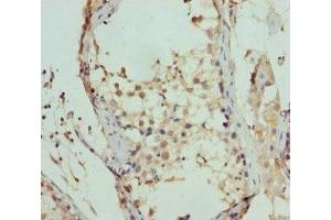 Immunohistochemistry of paraffin-embedded human testis tissue using ABIN7152449 at dilution of 1:100 (FBXO7 Antikörper  (AA 353-522))