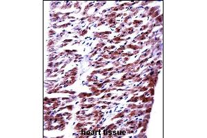 RM33 Antibody (C-term) ((ABIN657799 and ABIN2846772))immunohistochemistry analysis in formalin fixed and paraffin embedded human heart tissue followed by peroxidase conjugation of the secondary antibody and DAB staining. (MRPL33 Antikörper  (C-Term))