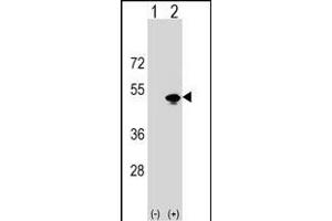 Western blot analysis of KRR1 (arrow) using rabbit polyclonal KRR1 Antibody (N-term) (ABIN1538757 and ABIN2848753). (KRR1 Antikörper  (N-Term))