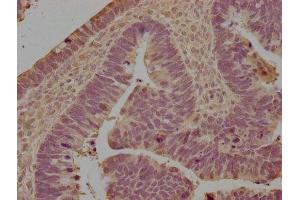 Immunohistochemistry (IHC) image for anti-Leukocyte Immunoglobulin-Like Receptor, Subfamily B (With TM and ITIM Domains), Member 5 (LILRB5) (AA 24-350) antibody (ABIN7158278)