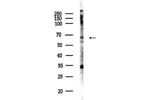 anti-Zinc Finger Protein 460 (ZNF460) (C-Term) antibody