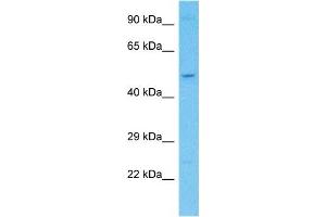 Host:  Rabbit  Target Name:  KCTD20  Sample Type:  Hela Whole Cell lysates  Antibody Dilution:  1.