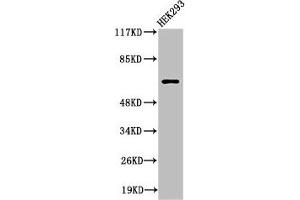 Western Blot analysis of 293 cells using Cleaved-ITI-H2 (D702) Polyclonal Antibody (ITIH2 Antikörper  (Cleaved-Asp702))