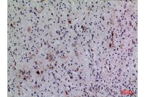 Immunohistochemistry (IHC) analysis of paraffin-embedded Human Brain, antibody was diluted at 1:100. (FGF5 Antikörper  (C-Term))