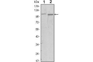 Western blot analysis using FAK mouse mAb against A549 (1) and NIH/3T3 (2) cell lysate. (FAK Antikörper)