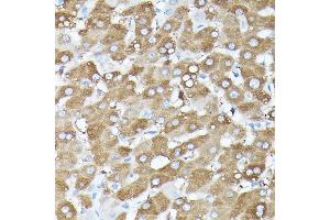 Immunohistochemistry (IHC) image for anti-G protein beta subunit-like (GBL) (AA 1-326) antibody (ABIN6143894)