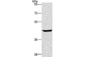 Western blot analysis of HT-29 cell, using GCK Polyclonal Antibody at dilution of 1:450