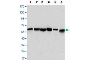 Western blot analysis using BECN1 monoclonal antibody, clone 2A4  against HeLa (1), A-431 (2), MCF-7 (3), Raji (4), Jurkat (5) and SK-BR-3 (6) cell lysate. (Beclin 1 Antikörper)