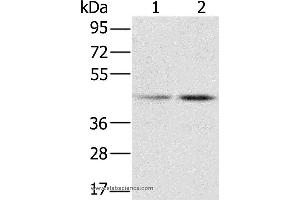 Western blot analysis of Hela and K562 cell, using RBMX Polyclonal Antibody at dilution of 1:800 (RBMX Antikörper)