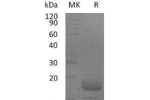 Western Blotting (WB) image for Interleukin 4 (IL4) protein (His tag) (ABIN7320597) (IL-4 Protein (His tag))