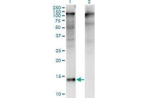 Western Blot analysis of ZBTB16 expression in transfected 293T cell line by ZBTB16 monoclonal antibody (M01), clone 3A7. (ZBTB16 Antikörper  (AA 381-480))