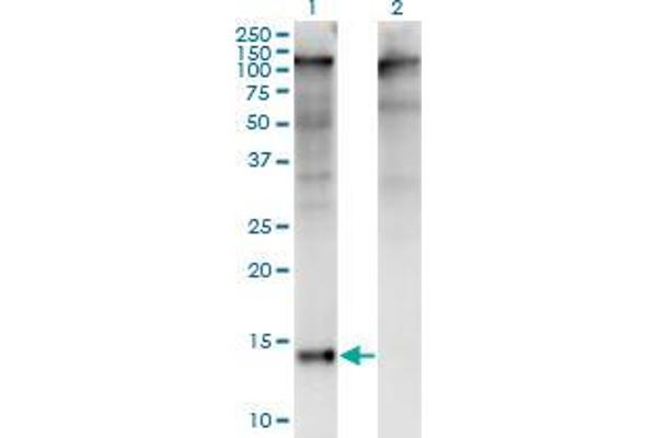 ZBTB16 antibody  (AA 381-480)