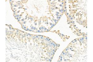 ABIN6257384 and ABIN6275302 at 1/100 staining Rat testis tissue by IHC-P.