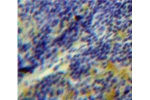 Immunohistochemistry (IHC) image for anti-serum/glucocorticoid Regulated Kinase Family, Member 3 (SGK3) (AA 141-368) antibody (ABIN1860541)