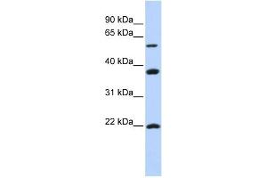 MYLIP antibody used at 1 ug/ml to detect target protein.