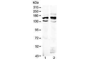 Western blot testing of 1) rat brain and 2) mouse brain lysate with Formin antibody at 0. (FMN1 Antikörper  (AA 1195-1419))