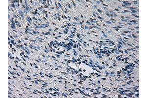 Immunohistochemical staining of paraffin-embedded liver tissue using anti-CYP2E1 mouse monoclonal antibody. (CYP2E1 Antikörper)