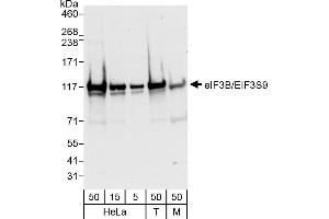 Western Blotting (WB) image for anti-Eukaryotic Translation Initiation Factor 3, Subunit B (EIF3B) (AA 1-50) antibody (ABIN7452883)
