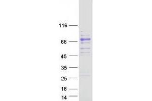 Western Blotting (WB) image for Coagulation Factor X (F10) protein (Myc-DYKDDDDK Tag) (ABIN2712927)
