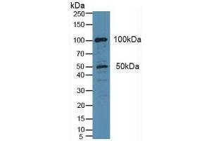 Western blot analysis of Human HeLa cells. (PLA2G4A Antikörper  (AA 1-178))