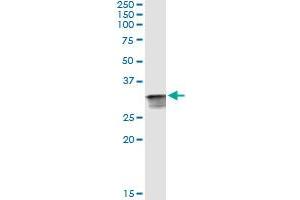 Immunoprecipitation of CDK2 transfected lysate using anti-CDK2 monoclonal antibody and Protein A Magnetic Bead , and immunoblotted with CDK2 MaxPab rabbit polyclonal antibody. (CDK2 Antikörper  (AA 1-298))