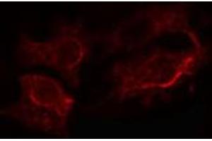 ABIN6272305 staining LOVO cells by IF/ICC. (GANAB Antikörper  (Internal Region))