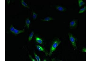 Immunofluorescent analysis of Hela cells using ABIN7169998 at dilution of 1:100 and Alexa Fluor 488-congugated AffiniPure Goat Anti-Rabbit IgG(H+L) (SLC17A3 Antikörper  (AA 1-125))