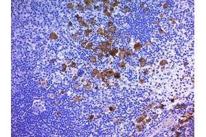 Formalin-fixed, paraffin-embedded human Hodgkin's Lymphoma stained with CD30 Monoclonal Antibody (Ber-H2 + CD30/412). (TNFRSF8 Antikörper)