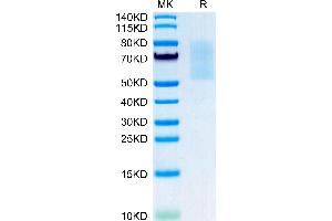 CX3CL1 Protein (AA 25-336) (His tag)