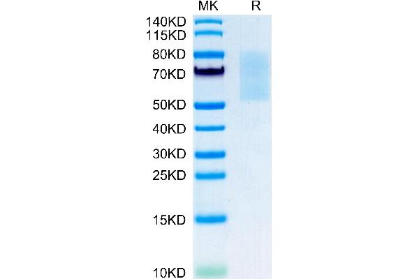 CX3CL1 Protein (AA 25-336) (His tag)