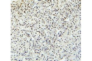 IHC analysis of PTBP2 using anti-PTBP2 antibody (ABIN7599452).