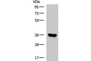 Western blot analysis of Human muscle tissue lysate using KCNK15 Polyclonal Antibody at dilution of 1:1000 (KCNK15 Antikörper)