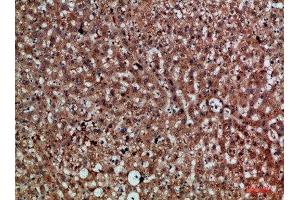 Immunohistochemical analysis of paraffin-embedded human-liver, antibody was diluted at 1:200 (CDNF Antikörper  (AA 31-80))