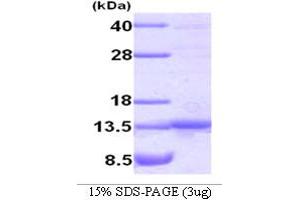 SDS-PAGE (SDS) image for TRAF Family Member-Associated NFKB Activator (TANK) (AA 1-119) protein (ABIN667036) (TANK Protein (AA 1-119))
