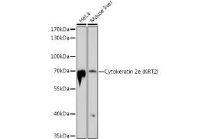 Western blot analysis of extracts of various cell lines, using Cytokeratin 2e (KRT2) antibody (ABIN6129540, ABIN6143025, ABIN6143026 and ABIN6214608) at 1:1000 dilution. (Keratin 2 Antikörper  (AA 1-220))