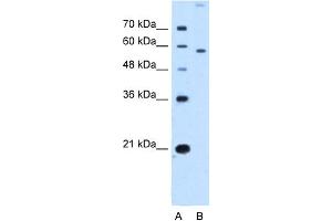WB Suggested Anti-SLC22A2 Antibody Titration:  2. (SLC22A2 Antikörper  (N-Term))