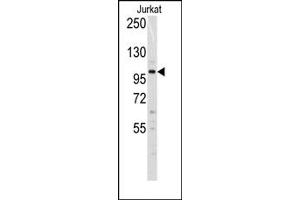 Image no. 1 for anti-DNA (Cytosine-5-)-Methyltransferase 3 alpha (DNMT3A) (N-Term) antibody (ABIN356568) (DNMT3A Antikörper  (N-Term))