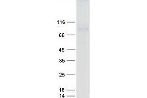Western Blotting (WB) image for ADAM Metallopeptidase with Thrombospondin Type 1 Motif, 4 (ADAMTS4) protein (Myc-DYKDDDDK Tag) (ABIN2714387)