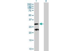 Western Blot analysis of C9orf152 expression in transfected 293T cell line by C9orf152 MaxPab polyclonal antibody. (C9orf152 Antikörper  (AA 1-218))