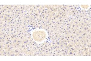 Detection of GLS2 in Mouse Liver Tissue using Polyclonal Antibody to Glutaminase 2 (GLS2) (GLS2 Antikörper  (AA 154-479))