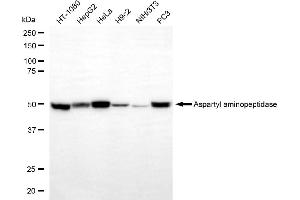 Western blotting analysis using aspartyl aminopeptidase antibody (ABIN7797664).