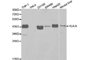 Western blot analysis of extracts of various cell lines, using HLA-A antibody. (HLA-A Antikörper  (AA 35-285))