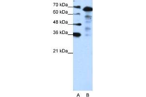 WB Suggested Anti-MLXIPL Antibody Titration:  1.