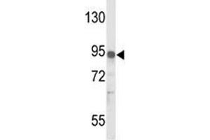 Western blot analysis of IL17RD antibody and MDA-MB231 lysate. (IL17RD Antikörper  (AA 217-245))
