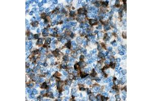 Immunohistochemical analysis of CDKL3 staining in human lymph node formalin fixed paraffin embedded tissue section. (CDKL3 Antikörper  (Center))